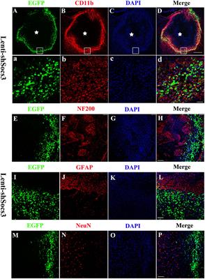 Reducing Suppressors of Cytokine Signaling-3 (SOCS3) Expression Promotes M2 Macrophage Polarization and Functional Recovery After Intracerebral Hemorrhage